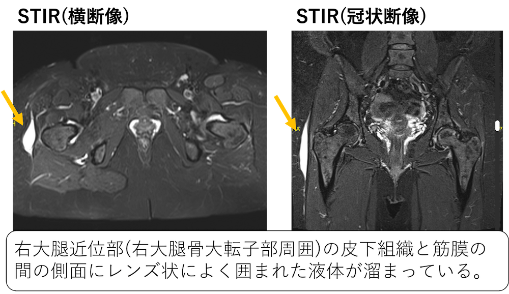 骨軟部